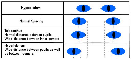 eye spacing anomalies